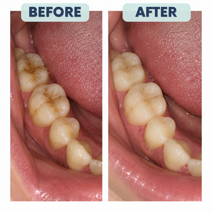 Rosalica 7.5% Nano-Hydroxyapatite Repair+ Toothpaste