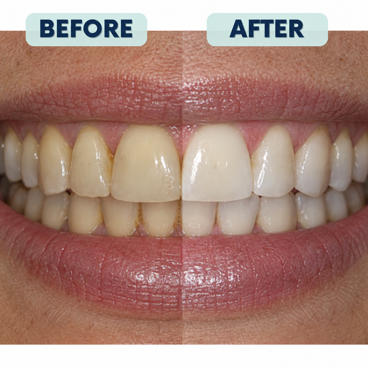 Rosalica 7.5% Nano-Hydroxyapatite Repair+ Toothpaste