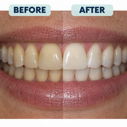 Rosalica 7.5% Nano-Hydroxyapatite Repair+ Toothpaste